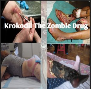 Krokodil Drug Effects