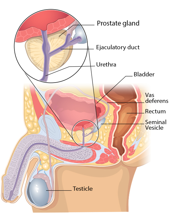 How To Detect Prostate Cancer 