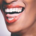 How to get rid of black gums