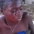 monkey pox in Nigeria