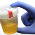 How Long Does Methadone Stay In Your Urine
