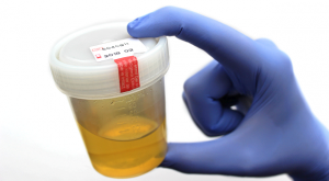 How Long Does Methadone Stay In Your Urine