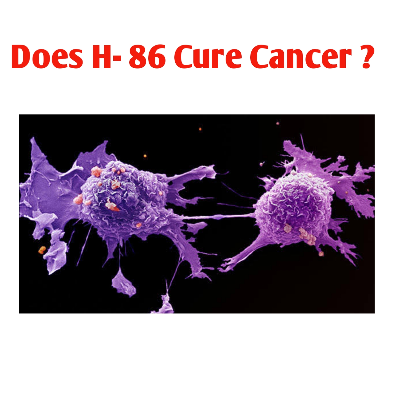 Does H86 Cure Cancer