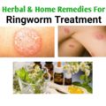 herbal Remedies For Ringworm Treatment