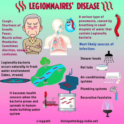 legionella risk assessment