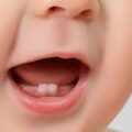 What Does a Pediatric Dentist Do?