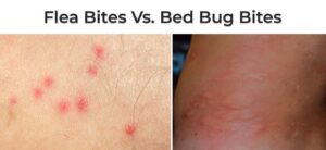 Bed bug bites vs. fleas
