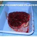 How To Dispose Placenta After Birth