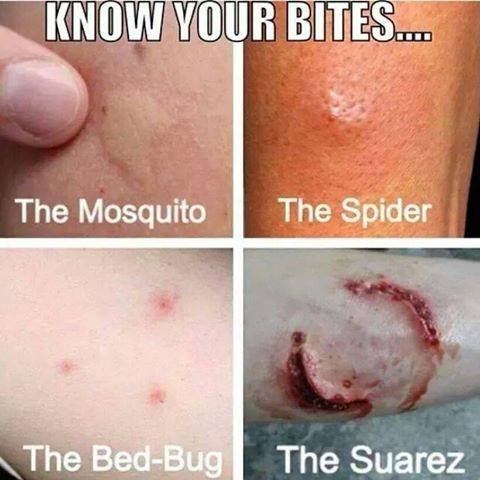 Bed bug bites vs. spider bites