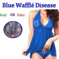 Blue Waffle Disease picture