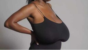 does pressing breast cause sagging