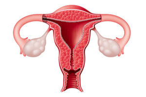 How To Clean Uterus After A Miscarriage Naturally