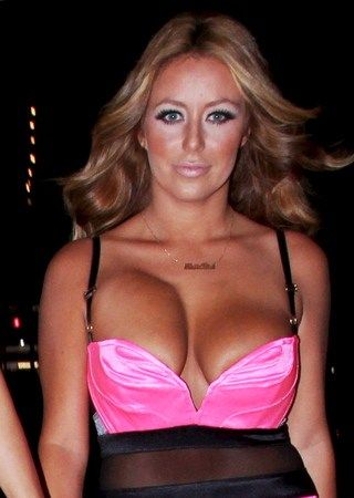 breast implants gone wrong pictures before and after 3