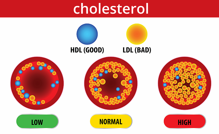 How To Lower Your Cholesterol With Fiber Foods