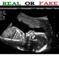 How to Spot a Fake Ultrasound
