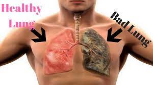 Is Vaping Bad For Your Lungs?