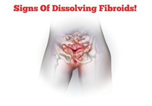 Signs of Fibroids Dissolving