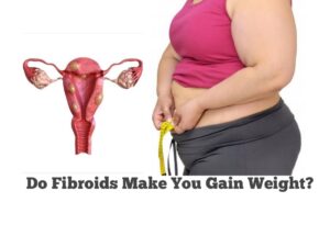 Do Fibroids Make You Gain Weight