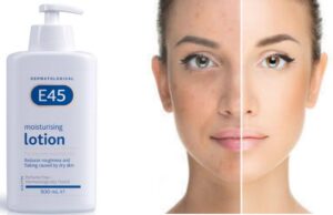 Does E45 lotion lighten skin