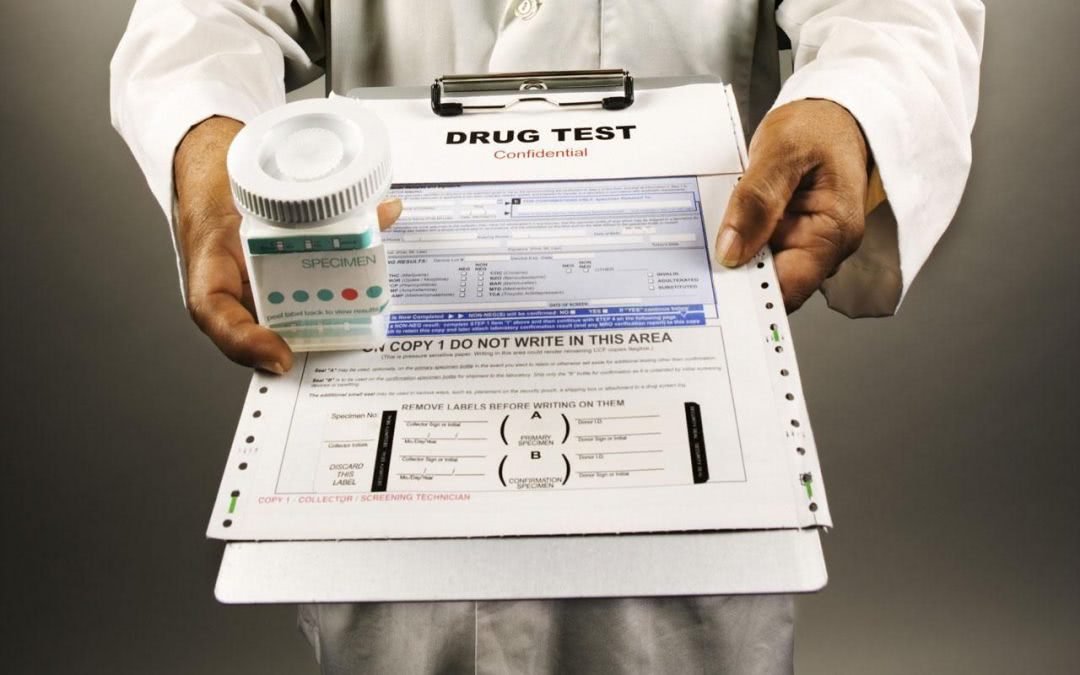  What Does Fentanyl Show Up As On A Drug Test
