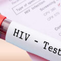 How Much Does HIV Test Cost In Nigeria