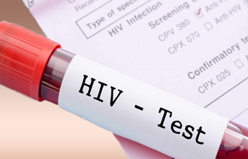 How Much Does HIV Test Cost In Nigeria