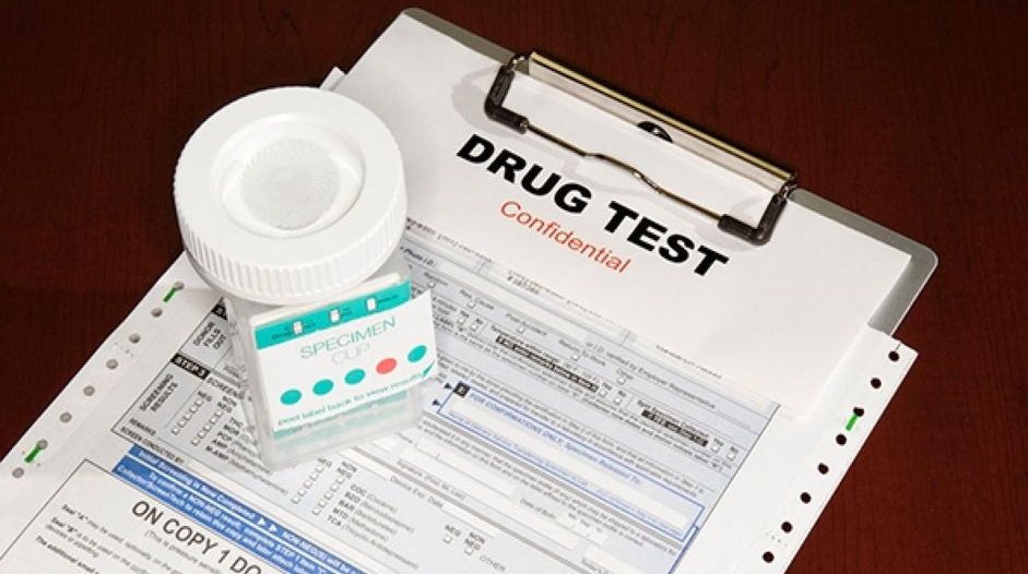 What Does BUP Mean On A Drug Test