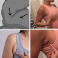 How To Get Rid Of Side Boob Fat