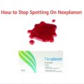 How To Stop Spotting On Nexplanon