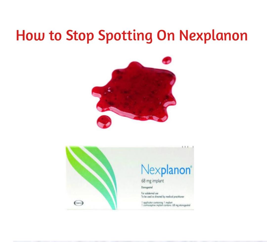 How To Stop Spotting On Nexplanon