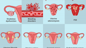 How Can I Make My Uterus Healthy