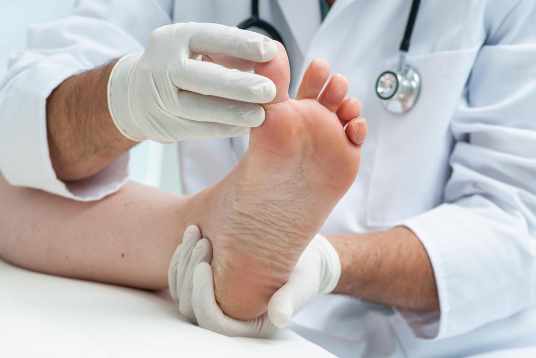 Diabetic Foot Infection Pictures