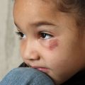 How Child Abuse & Neglect is Linked to Early Death