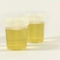 Can Labs Tell The Difference Between Real And Synthetic Urine