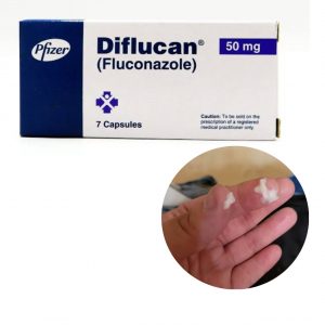 Clumpy Discharge After Taking Fluconazole
