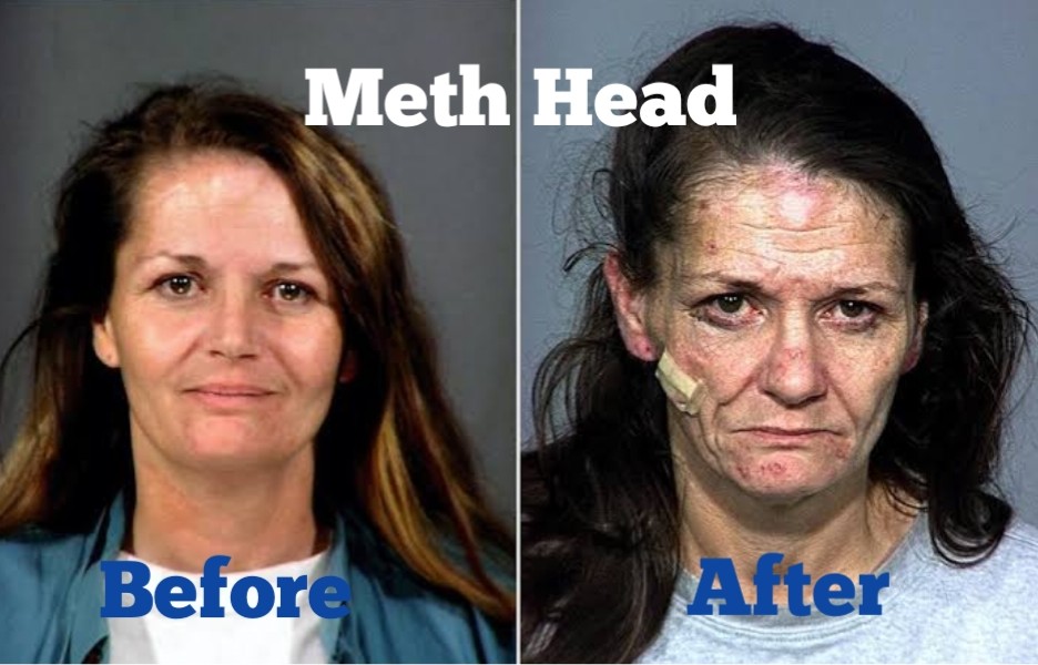 Meth Head