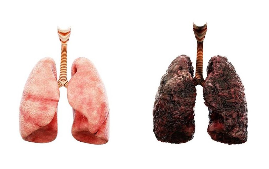 Do Smokers’ Lungs Heal After Quitting? Public Health