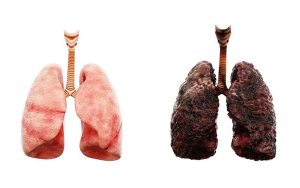 Do Smokers' Lungs Heal After Quitting