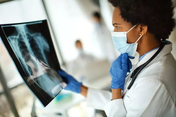 Humans Outperform AI in Interpreting Chest X-Rays